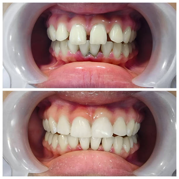 Best Full Mouth Reconstruction  in Hayward, WI